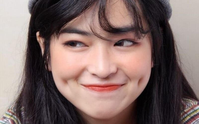 má lúm đồng điếu trong nhân tướng học