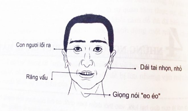 Nhân tướng học kẻ giết người