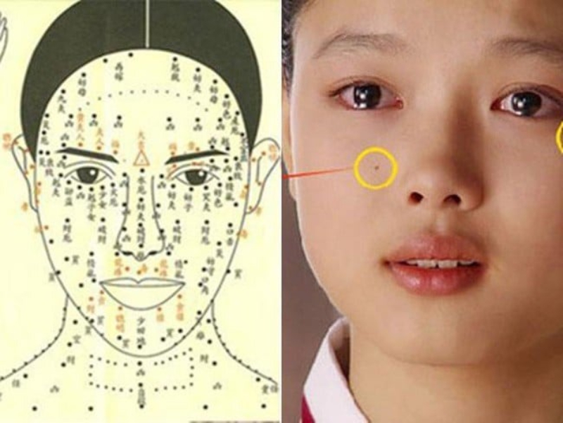 nhân tướng học nốt ruồi trên mặt