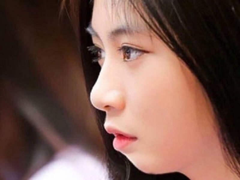 nọng cằm trong nhân tướng học
