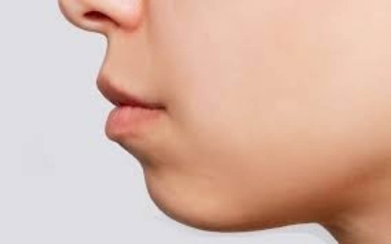 nọng cằm trong nhân tướng học