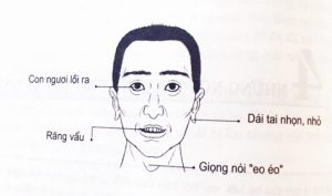 Nhân tướng học kẻ giết người